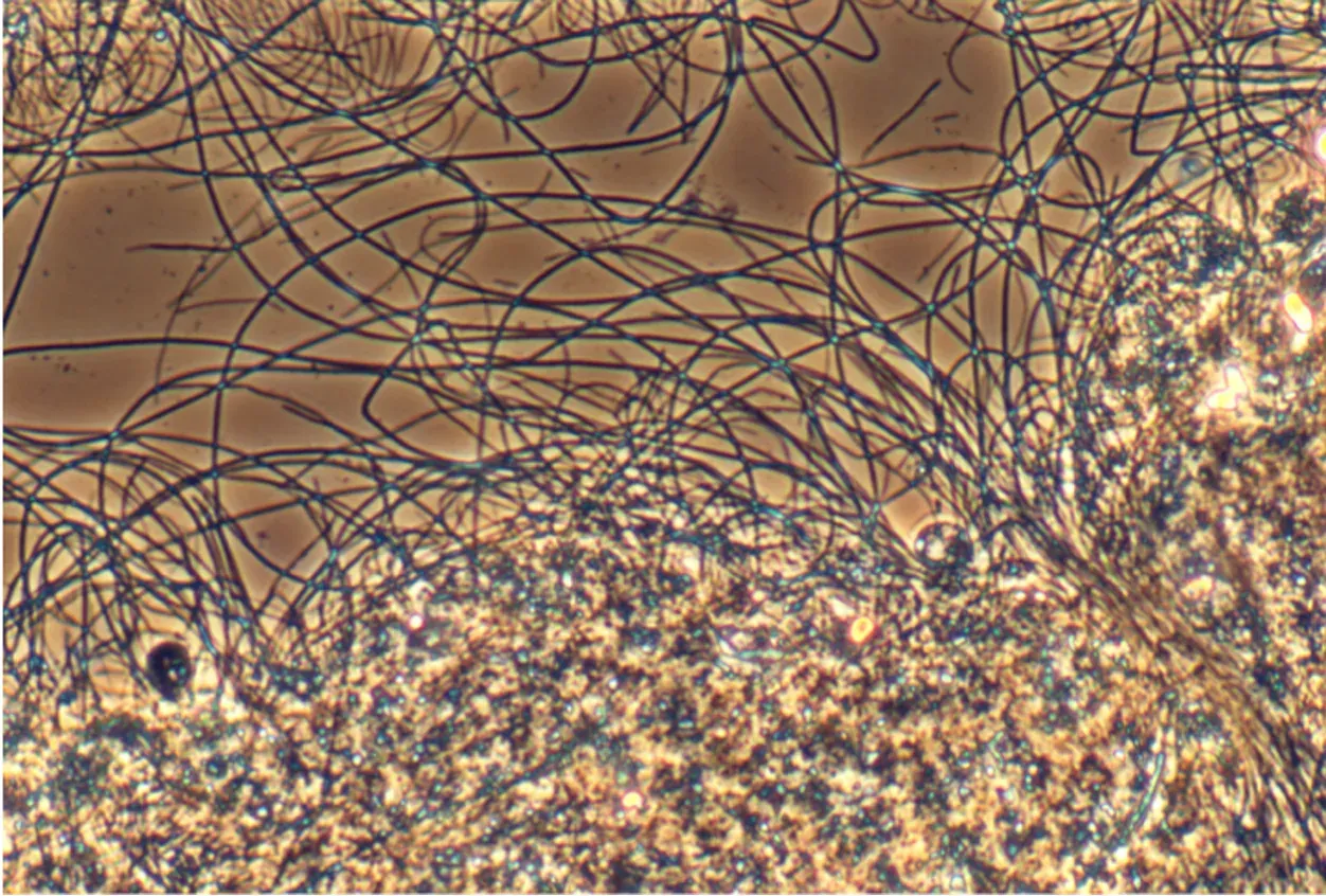 Filamentous bacteria under the microscope